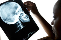 student looking at x-ray
